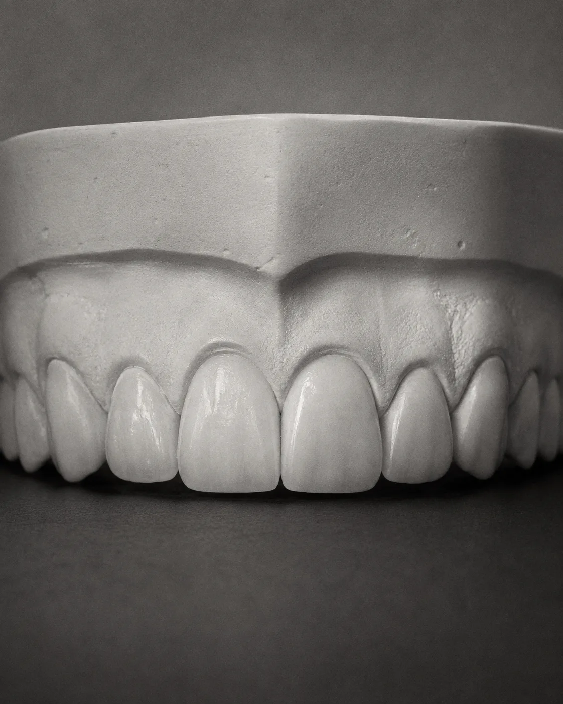 AI-generated dental teaching model: implants after. Illustrative only; not a patient outcome.