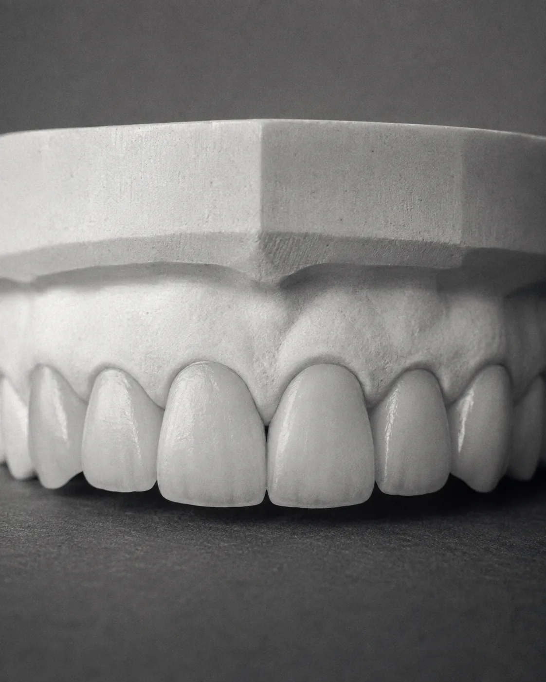 AI-generated dental teaching model: veneers after. Illustrative only; not a patient outcome.
