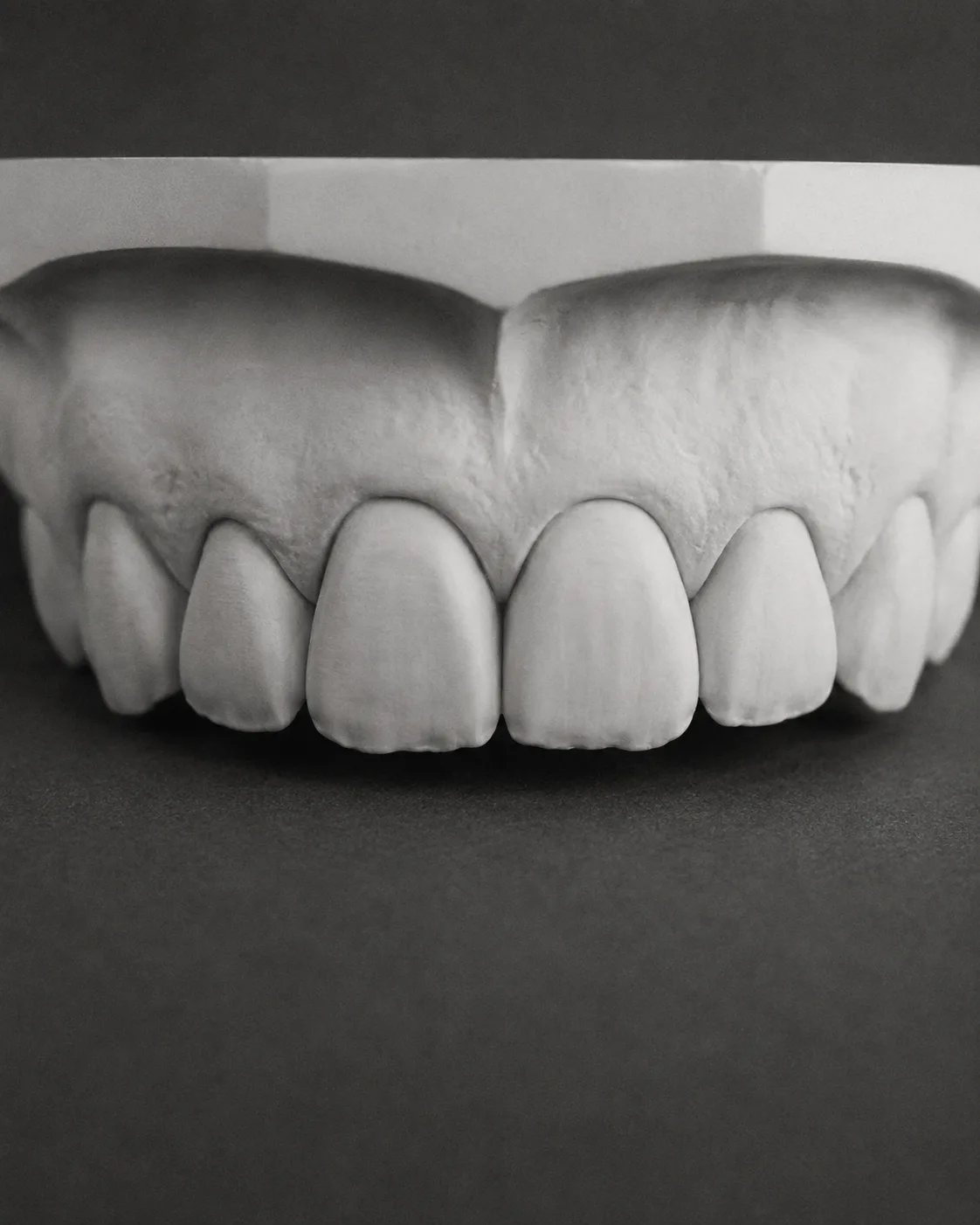 AI-generated dental teaching model: veneers before. Illustrative only; not a patient outcome.